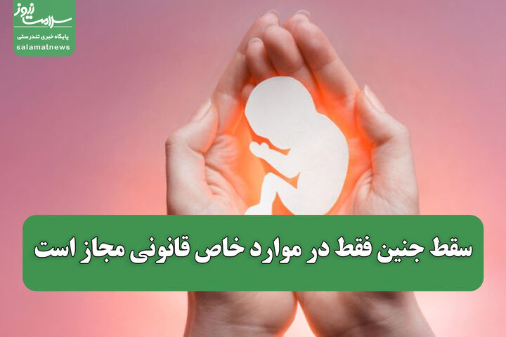 سقط جنین فقط در موارد خاص قانونی مجاز است؛ سندروم داون هم استثناء ندارد