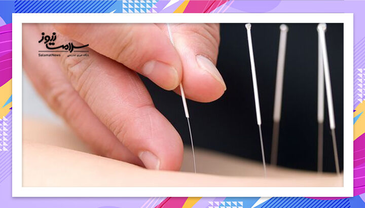 طب سوزنی؛ راهی نو برای تسکین کمردرد مزمن سالمندان