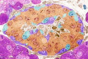 ویرایش ژن، امیدی تازه برای درمان دیابت نوع یک