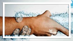 چرا پاییز فصل آبرسانی به بدن است؟