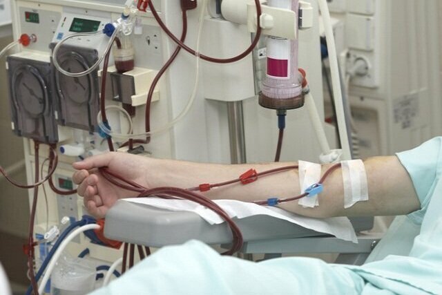 ۱۸۷ تخت دیالیز در لرستان وجود دارد