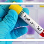 ویروس نیپا چیست و چقدر باید نگران آن باشیم؟